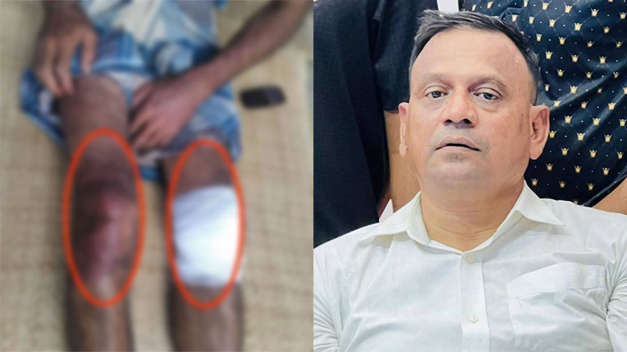 সোনাগাজীতে চাঁদার দাবিতে টমটম চালককে বৈদ্যুতিক শক যুবদল নেতার