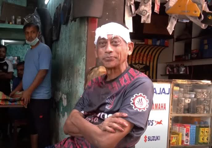 যশোরে বাড়ির সামনে ময়লা ফেলা নিয়ে বিরোধ, লাঠির আঘাতে আহত শিল্পী সমু চৌধুরী