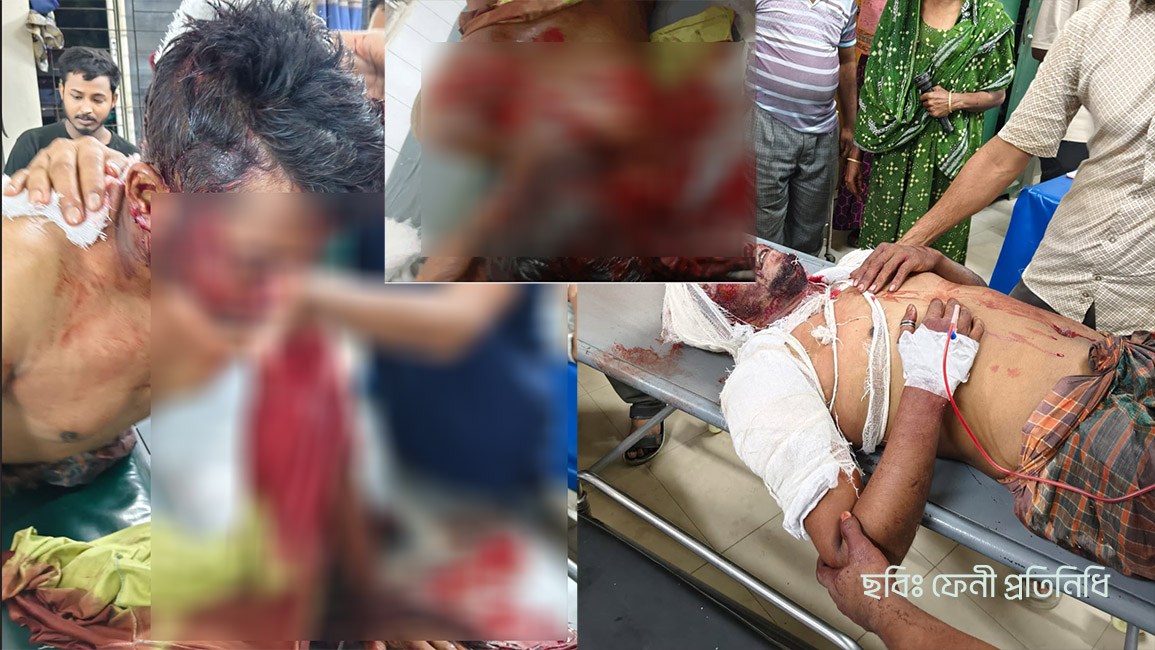 ফেনীতে যুবলীগ নেতাকে কুপিয়ে হত্যাচেষ্টা, আশঙ্কাজনক অবস্থায় হাসপাতালে চিকিৎসাধীন